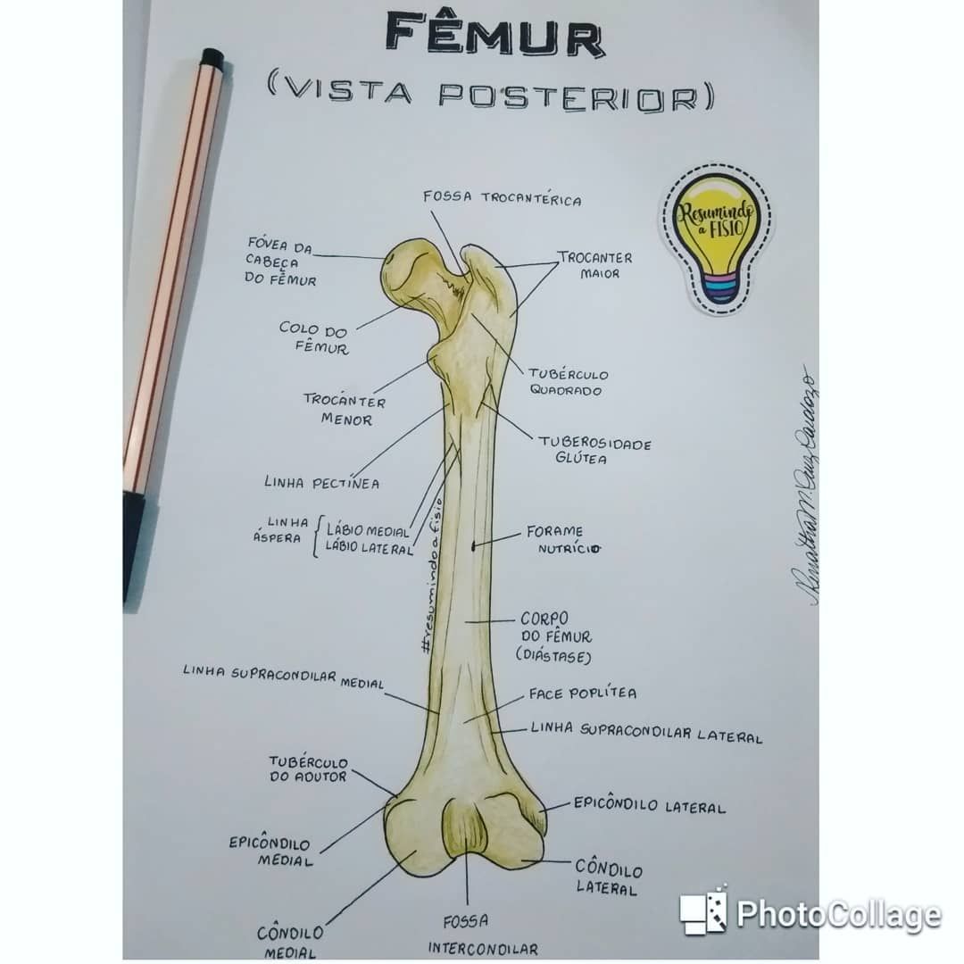 efractura